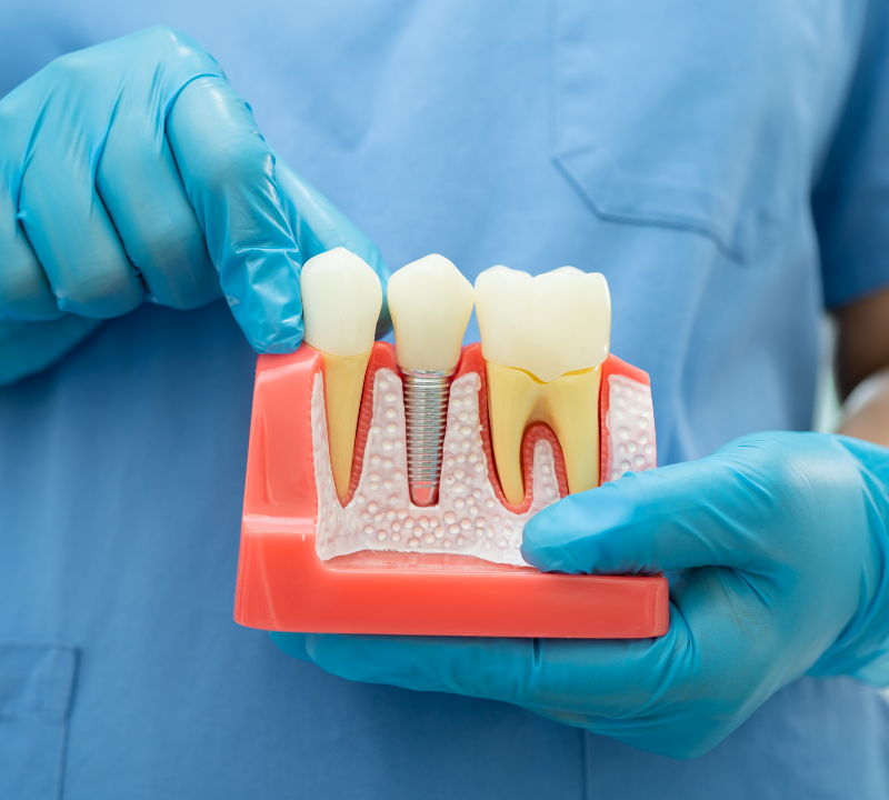 alexvdental 10